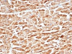 SDHB Antibody (SDHB/6697R) - Azide and BSA Free, Novus Biologicals 100